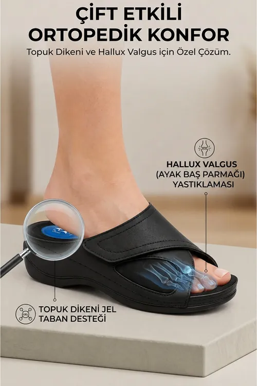 Siyah Topuk Dikeni Destekli Jel Tabanlı Hallux Valgus Uyumlu Günlük Rahat Kadın Terlik