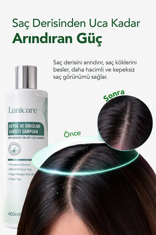 Kepek Ve Dökülme Karşıtı Şampuan Kepek Karşıtı Tuzsuz Sampuan 400 ml