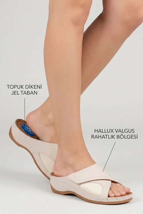 Bej Topuk Dikeni Destekli Jel Tabanlı Hallux Valgus Uyumlu Günlük Rahat Kadın Terlik