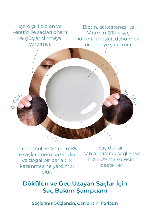 9 Aktifli Saç Dökülmesine Karşı Hızlı Saç Uzatan & Onarıcı Dolgunlaştırıcı Besleyici Şampuan 400 ML