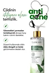 Akne Karşıtı Yüz Yıkama Jeli + Akne Karşıtı Tonik Set